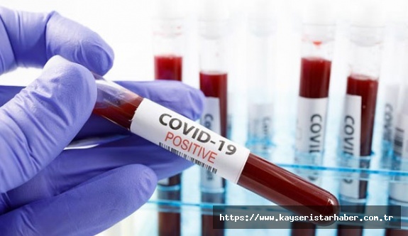 Almanya'da Covid-19 hastalarının yüzde 84'ü iyileşti